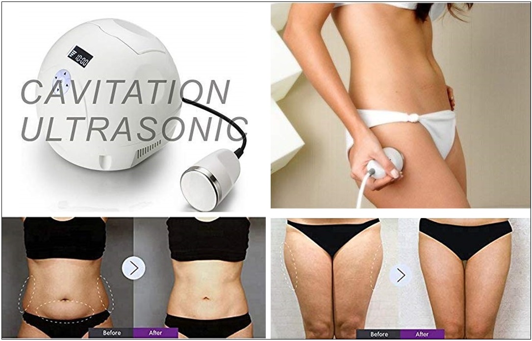 Ultrasonic cavitation machine for simple non surgical diy removal of cellulite